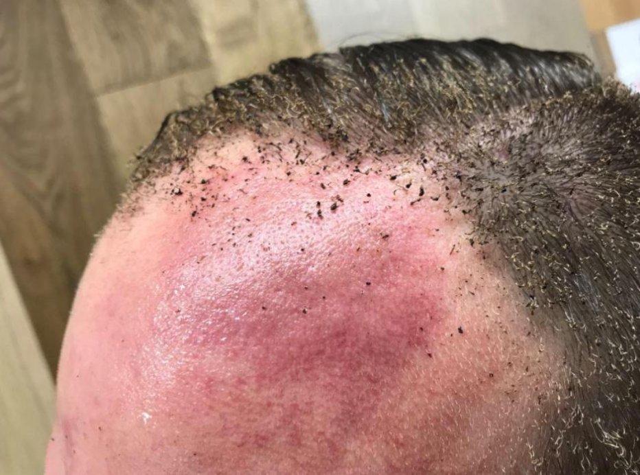 Londra metrosunda patlama