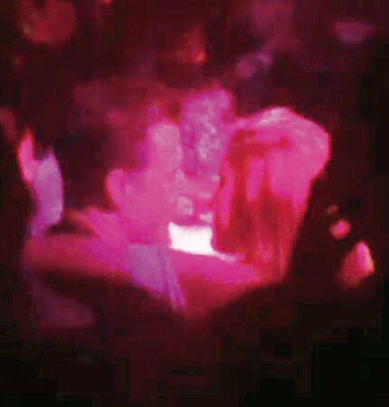 Erden Kınay karısını aldattı