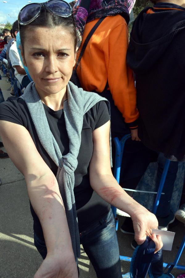 Erdoğan'ın dikkatini çekmek için ağaca çıktı