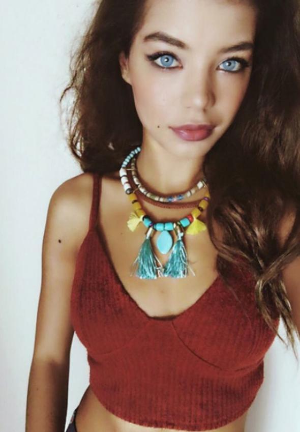 Buse Narcı ameliyatla mavi gözlü oldu