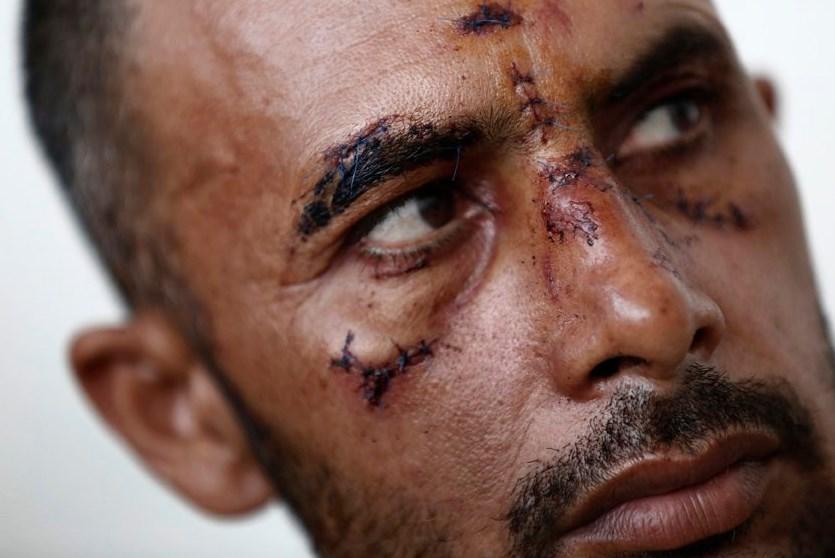 Yunan faşistlerden göçmenlere saldırı