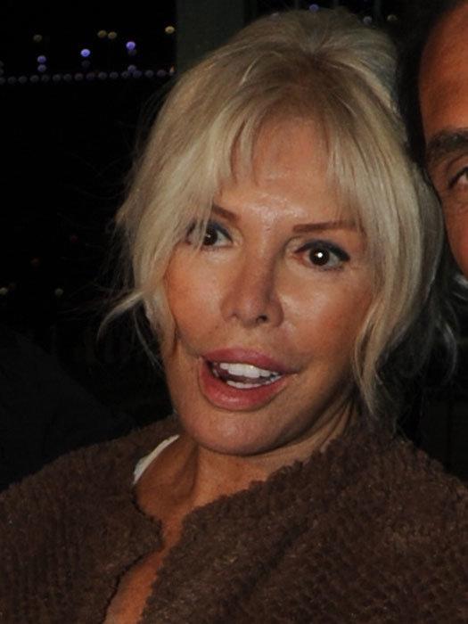 Ajda Pekkan dişsiz görüntülendi