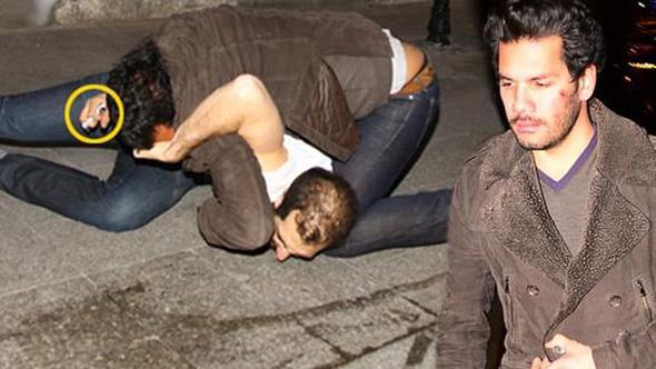 Rüzgar Çetin'in yüzündeki iz incelenecek