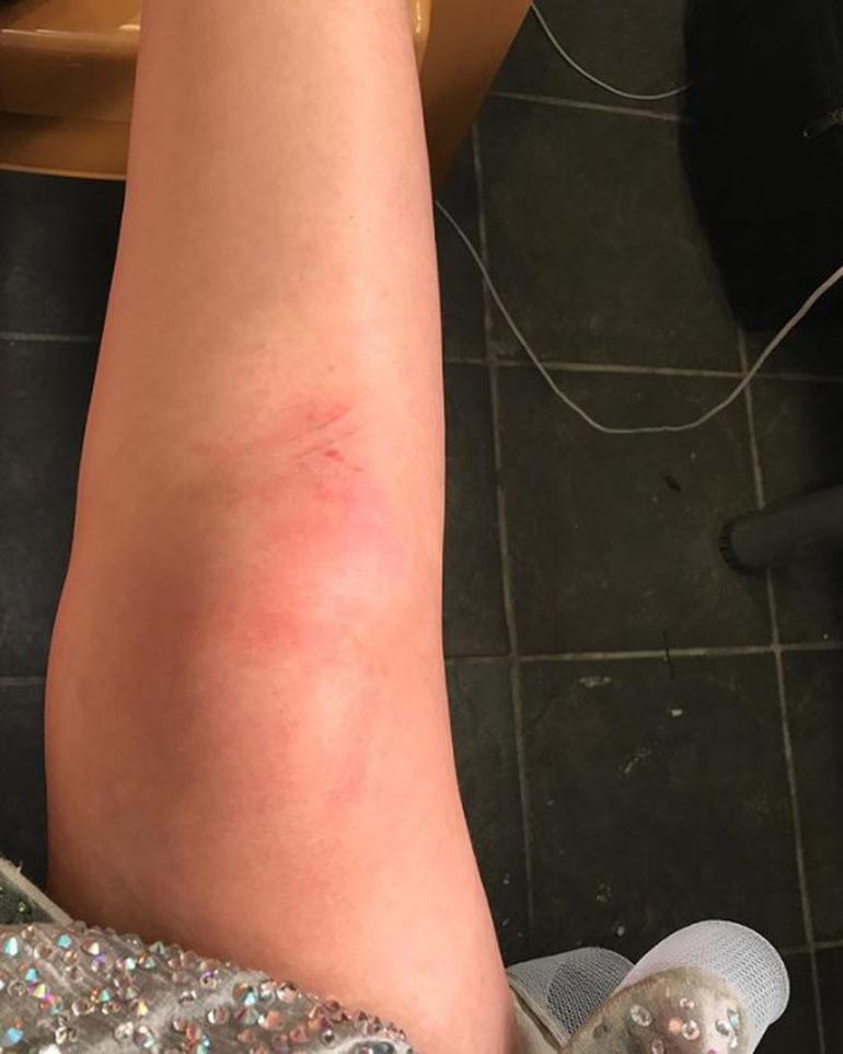 Aylin Coşkun klip çekiminde düştü