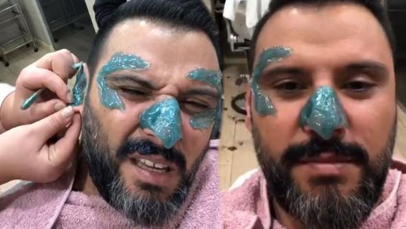 Alişan'ın cilt bakımı pişmanlığı