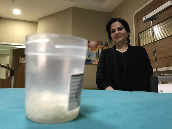 Dizlerinden 967 adet eklem faresi çıktı