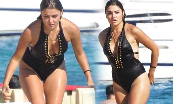 Hande Erçel bıçak altına yattı