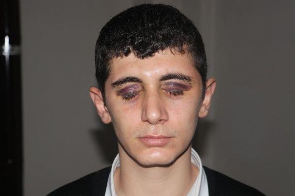 Adana'da 5 kişi engelli genci darbetti