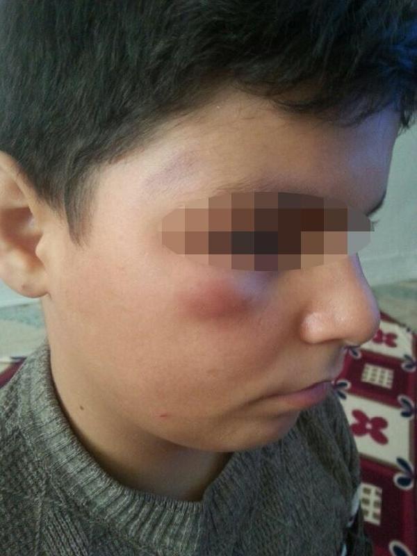 Darbedilen öğrenci şikayetçi olunca okuldan uzaklaştırıldı