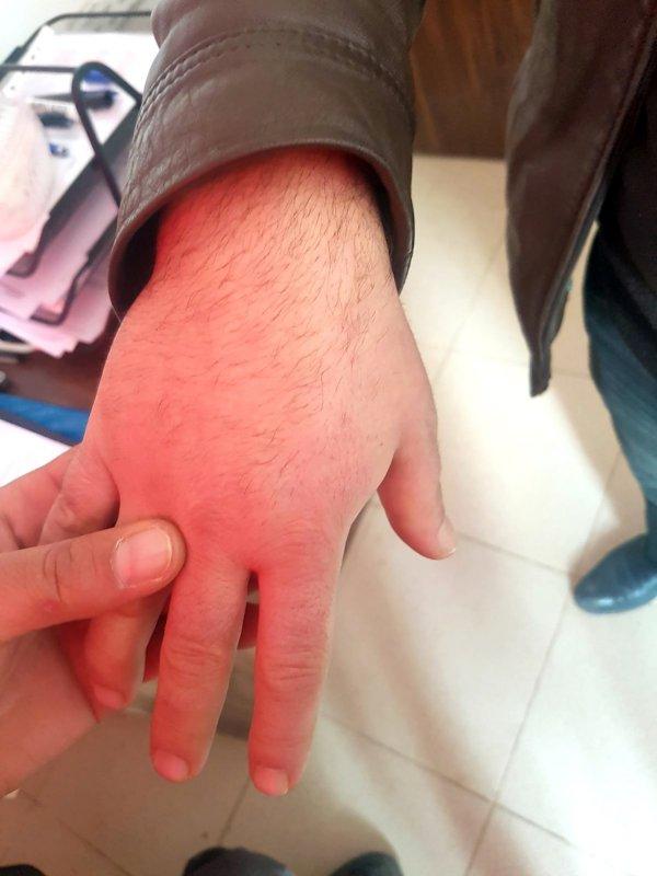 Dicle Elektrik çalışanlarına saldıranlardan 1'i tutuklandı