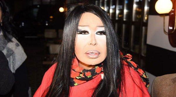 Ayşe Tolga: Diva'nın yüzü tanınmaz halde