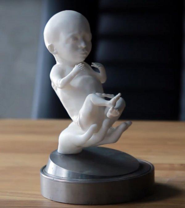 Doğmamış bebeği 3D yazıcıyla üretiyorlar