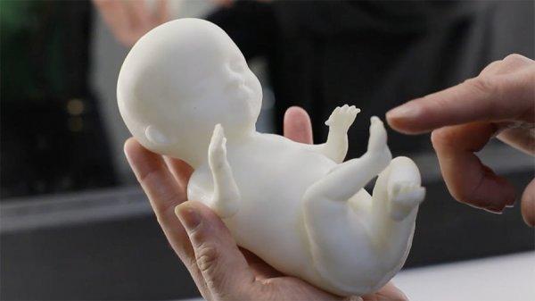 Doğmamış bebeği 3D yazıcıyla üretiyorlar