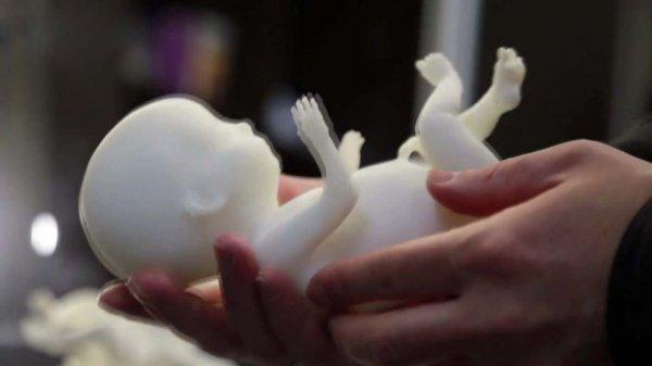 Doğmamış bebeği 3D yazıcıyla üretiyorlar