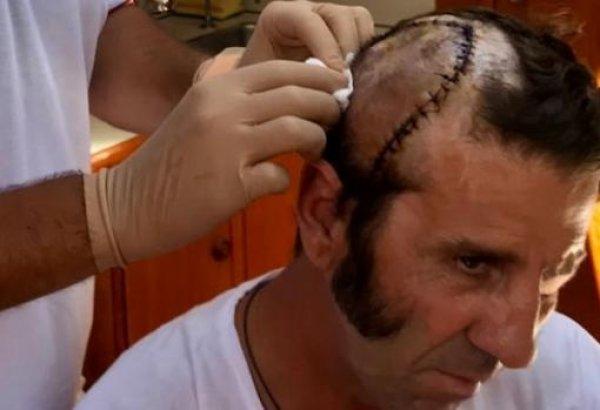 Boğanın boynuzladığı matadorun kafa derisi yüzüldü