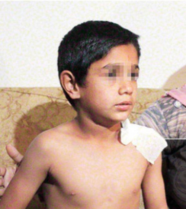 Suriyeli çocuğa sıcak su döken çalışan hakkında karar