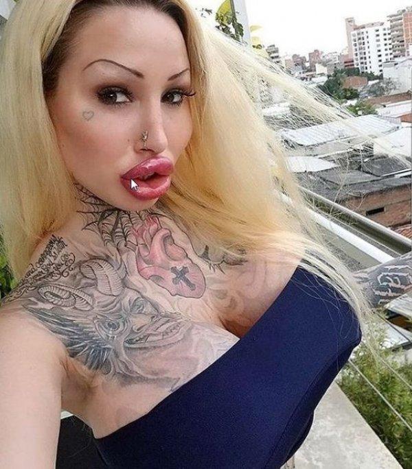 Estetik bağımlısı kadın pes dedirtti