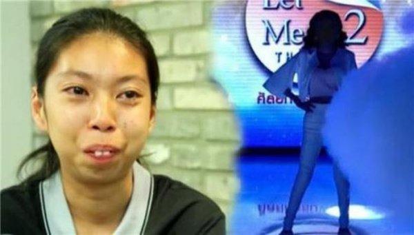 Taylandlı kadının ameliyat sonrası muhteşem değişimi