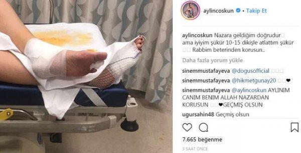 Aylin Coşkun'un ayaklarına dikiş atıldı