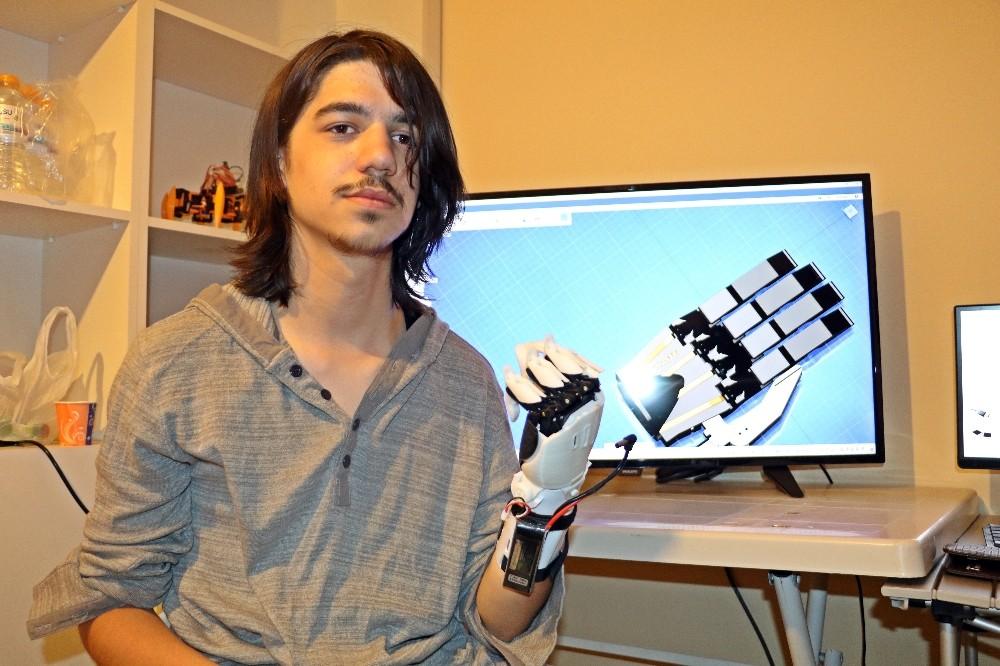 Deney yaparken ellerini ve gözünü kaybetti ama vazgeçmedi