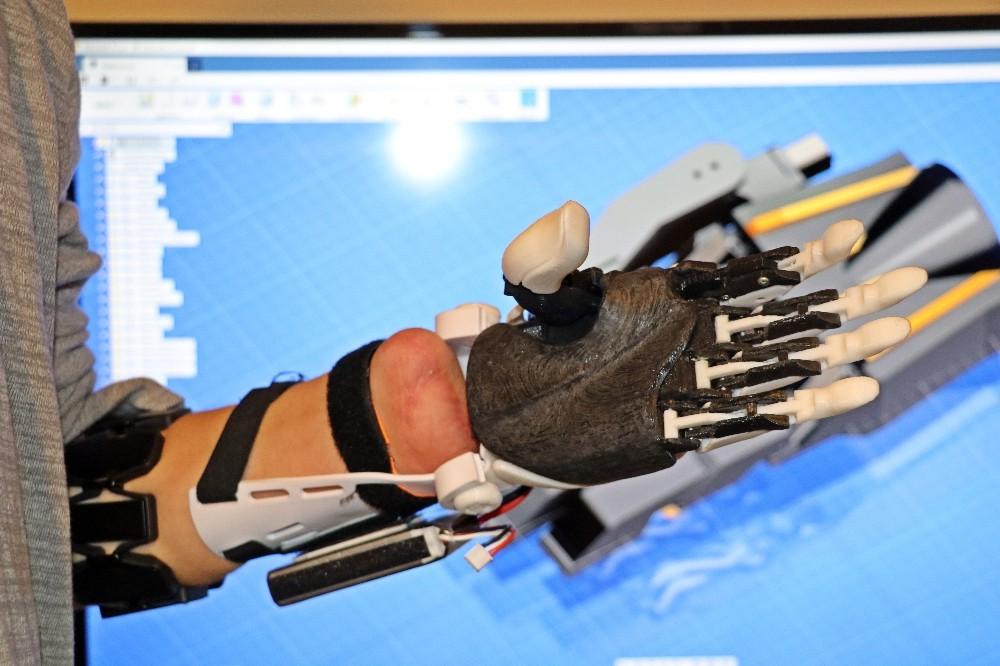 Deney yaparken ellerini ve gözünü kaybetti ama vazgeçmedi