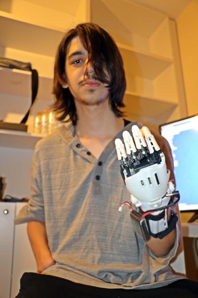 Deney yaparken ellerini ve gözünü kaybetti ama vazgeçmedi