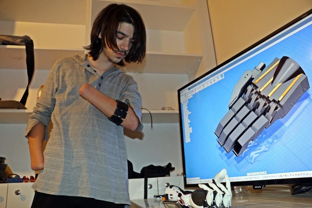 Deney yaparken ellerini ve gözünü kaybetti ama vazgeçmedi