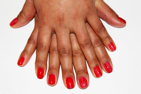 Vücudumuz hastalıklara dair ipuçları veriyor