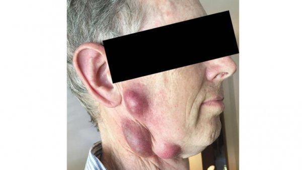 ABD'li yaşlı adam kedisinden ölümcül bakteri kaptı