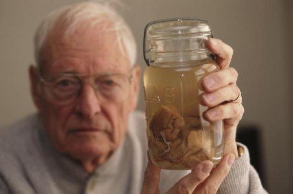 Einstein’ın beyninin trajikomik bir hikayesi var