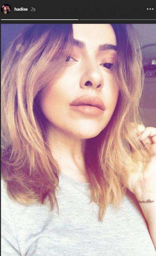 Hadise'nin yeni dudakları