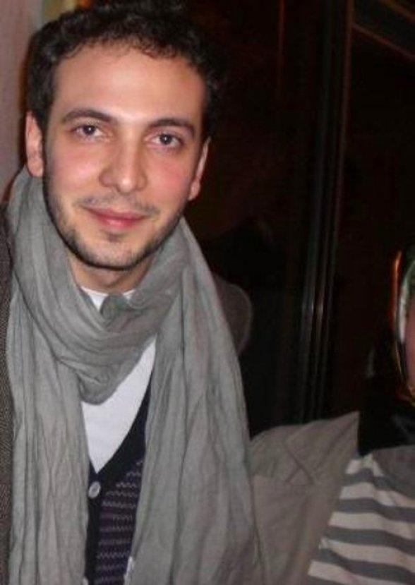 Oğuzhan Koç protez saç yaptırdı