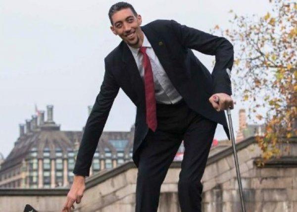 Akromegali hastalığı nedir