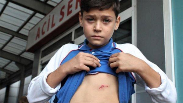 Bursa'da aç kalan köpekler 12 yaşındaki çocuğa saldırdı