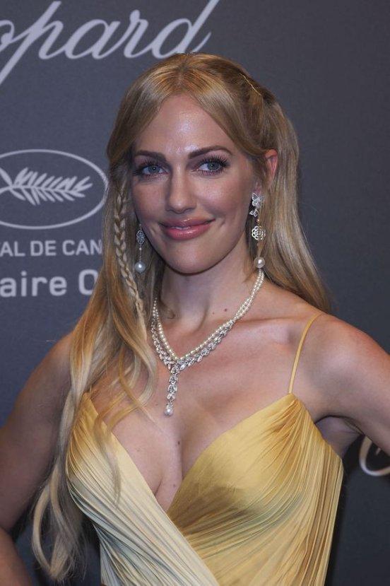 Meryem Uzerli dolgularını aldırıyor