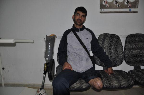 6 bin 500 Suriyeliye protez takıldı