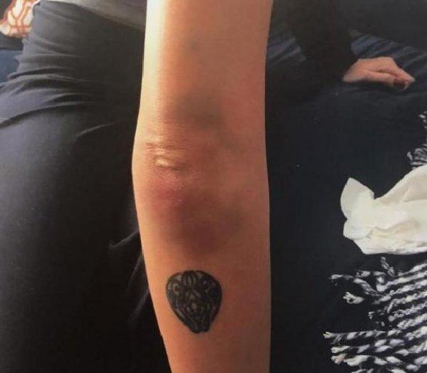 Sıla Gençoğlu'nun darp raporu