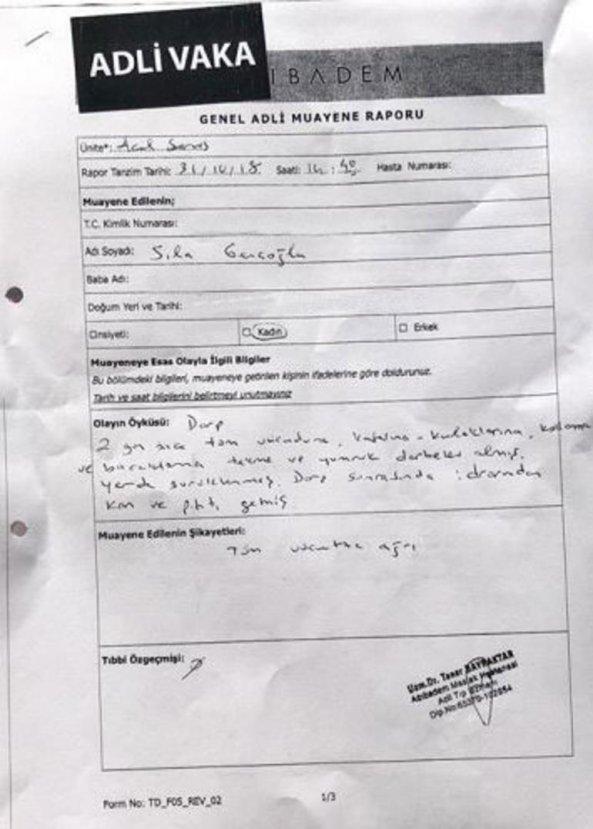 Sıla Gençoğlu'nun darp raporu