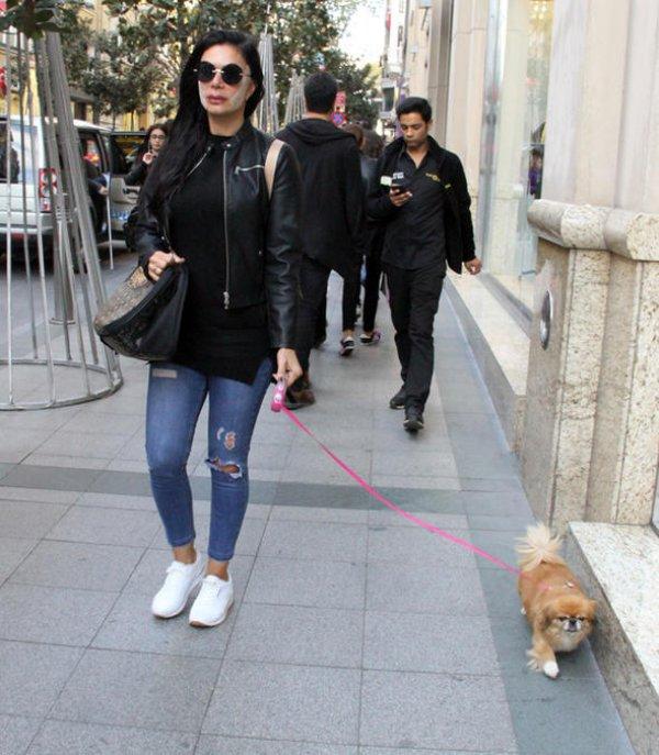 Sevda Demirel Kim Kardashian ameliyatı oldu