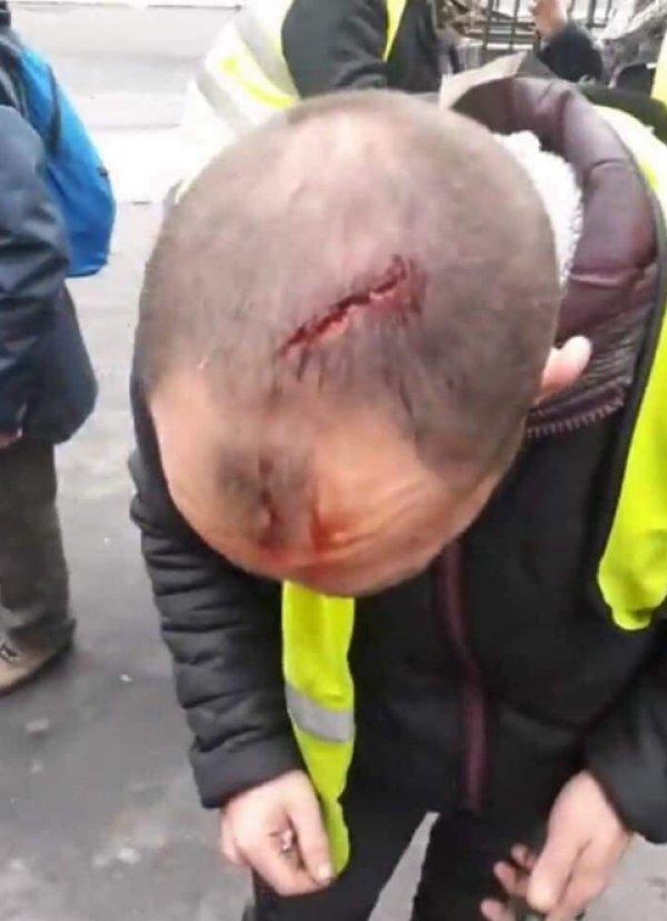 Fransa'da çatışmalar polis şiddetine dönüştü