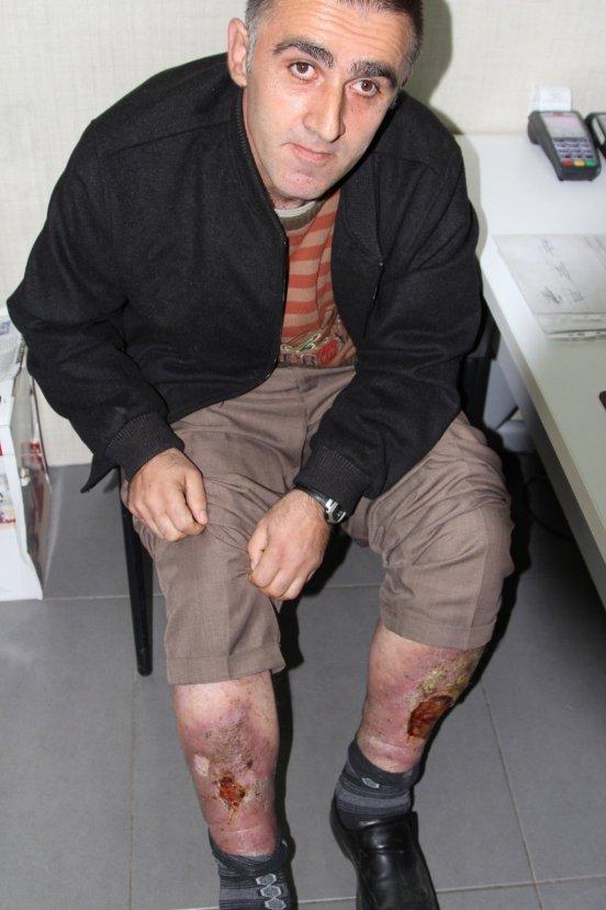 Rize'de Behçet hastasının isyan ettiği durum