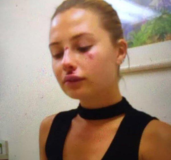 Serdar Ortaç'tan dayak açıklaması