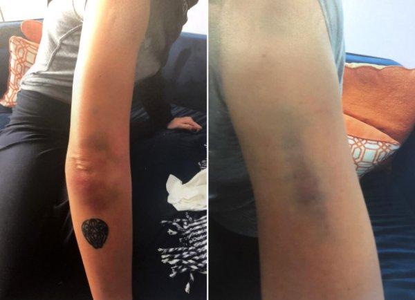 Sıla'nın Adli Tıp raporu