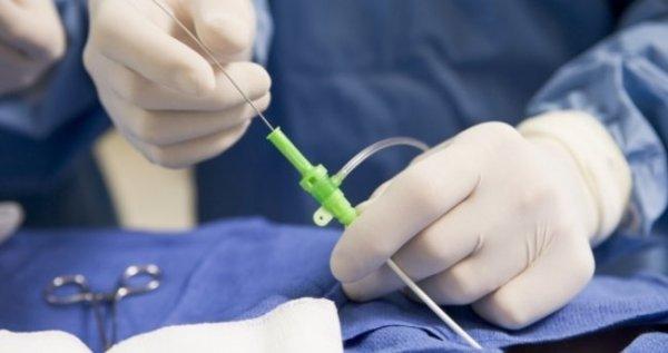 Beyin anjiyosu nedir