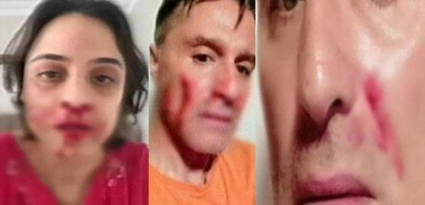 Hazım Körmükçü kadınlardan özür diledi