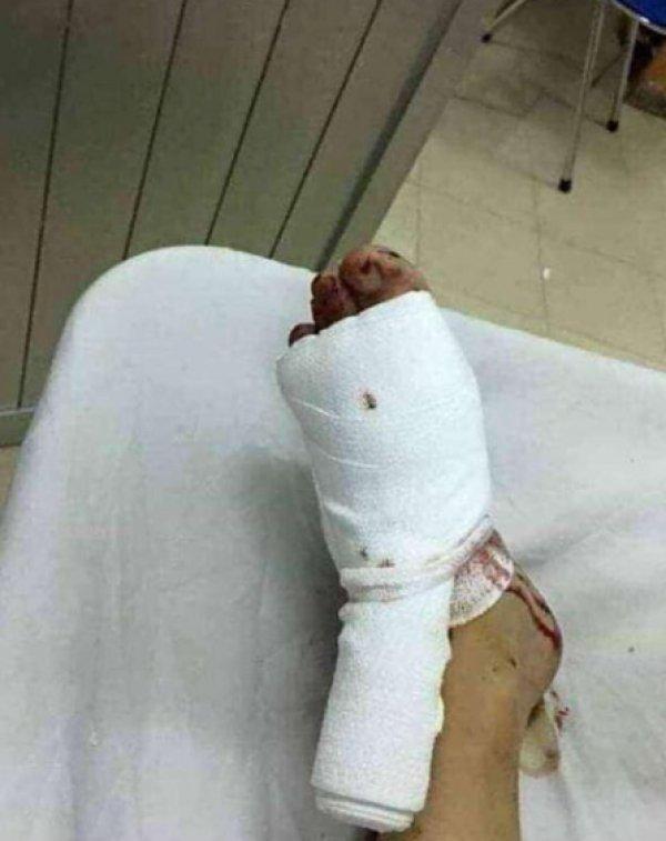 Yatak fantezisi yüzünden canından oluyordu