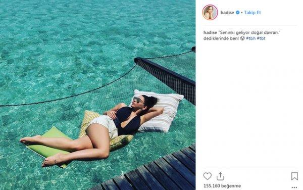 Hadise: Seninki geliyor doğal davran