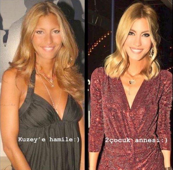 10 yılda değişim gösteren ünlüler