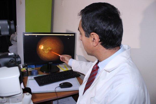 İzmir'de iki genç kadın kedi parazitinden kör oldu