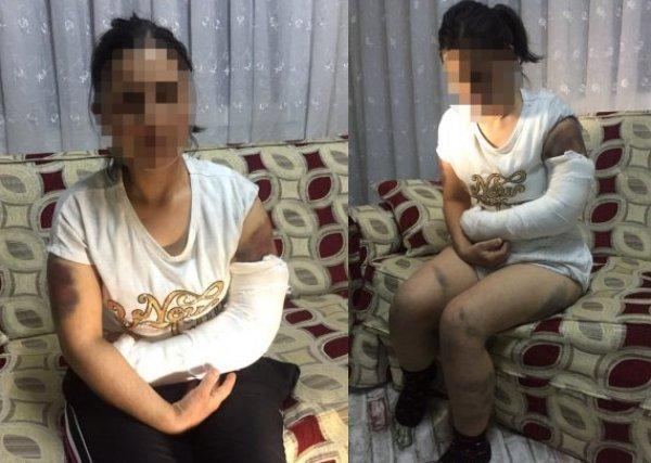 Aldatıldığını düşünen Adanalı adam eşini demirle dövdü